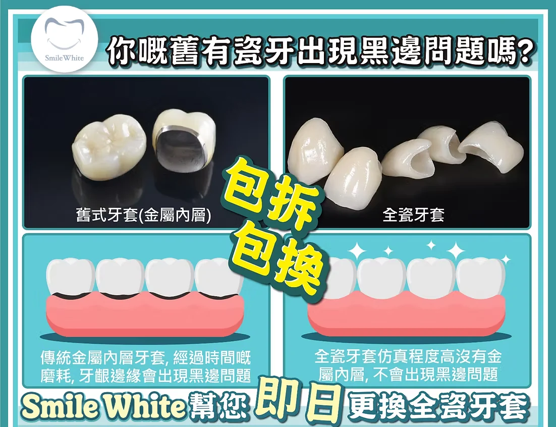 你嘅舊有瓷牙出現黑邊問題嗎？舊式牙套有金屬內層，經過時間嘅磨耗，牙齦邊緣會出現黑邊問題；全瓷牙套仿真程度高、沒有金屬內層，不會出現黑邊問題。Smile White 幫您即日更換全瓷牙套，包拆包換。